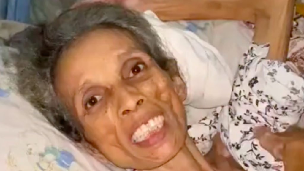 Kartinah, warga Parung Bogor yang tengah berjuang melawan penyakit.